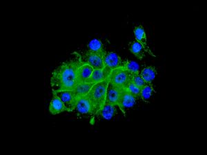 Immunofluorescent staining of BxPC-3 cells using anti-PHLDA1 antibody.