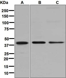 Western blot analysis on (A) human melanoma, (B) A375, and (C) BxPC-3 lysates using anti-PHLDA1 antibody.