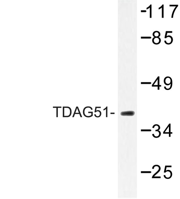 Western blot of TDAG51 (A149) pAb in extracts from RAW264.7.
