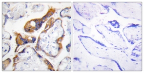 IHC of paraffin-embedded human placenta, using PHLA2 Antibody. The picture on the right is treated with the synthesized peptide.