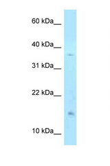 PHLDA2 antibody LS-C146041 Western blot of 293T Cell lysate. Antibody concentration 1 ug/ml.