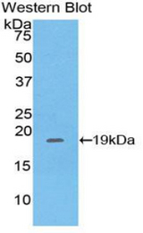 Western blot of recombinant PHLDA2 / TSSC3.