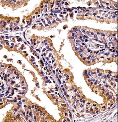 PHLDA2 Antibody immunohistochemistry of formalin-fixed and paraffin-embedded human prostate tissue followed by peroxidase-conjugated secondary antibody and DAB staining.
