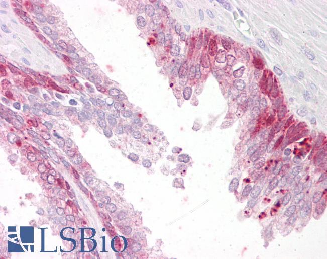 Anti-PHLDA2 antibody IHC of human prostate. Immunohistochemistry of formalin-fixed, paraffin-embedded tissue after heat-induced antigen retrieval. Antibody LS-B7335 concentration 3.75 ug/ml.