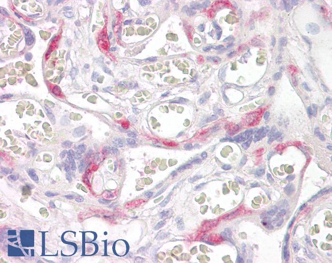Anti-PHLDA2 antibody IHC of human placenta. Immunohistochemistry of formalin-fixed, paraffin-embedded tissue after heat-induced antigen retrieval. Antibody LS-B7335 concentration 3.75 ug/ml.