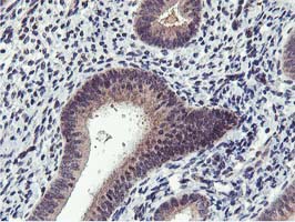 IHC of paraffin-embedded Human endometrium tissue using anti-MIER2 mouse monoclonal antibody. (Heat-induced epitope retrieval by 10mM citric buffer, pH6.0, 100C for 10min).