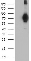 HEK293T cells were transfected with the pCMV6-ENTRY control (Left lane) or pCMV6-ENTRY MIER2 (Right lane) cDNA for 48 hrs and lysed. Equivalent amounts of cell lysates (5 ug per lane) were separated by SDS-PAGE and immunoblotted with anti-MIER2.