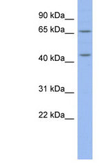 MIER3 antibody LS-C110458 Western blot of Mouse Pancreas lysate. Antibody concentration 1 ug/ml.