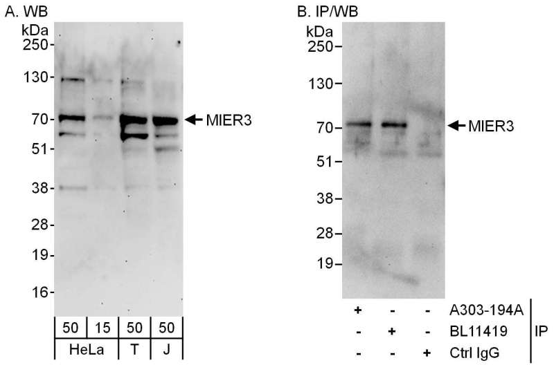 Detection of Human MIER3 by Western Blot and Immunoprecipitation. Samples: Whole cell lysate from HeLa (15 and 50 ug for WB; 1 mg for IP, 20% of IP loaded), 293T (T; 50 ug) and Jurkat (J; 50 ug) cells. Antibodies: Affinity purified rabbit anti-MIER3 antibody used for WB at 0.4 ug/ml (A) and 1 ug/ml (B) and used for IP at 6 ug/mg lysate. MIER3 was also immunoprecipitated by rabbit anti-MIER3 antibody BL11419, which recognizes a downstream epitope. Detection: Chemiluminescence with exposure times of 3 minutes (A) and 30 seconds (B).
