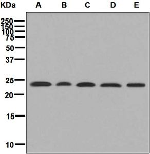 Western blot analysis on (A) HeLa, (B) A549, (C) HT-1376, (D) MDA-MB-435, and (E) PC-3 cell lysates using anti-PI15 antibody.