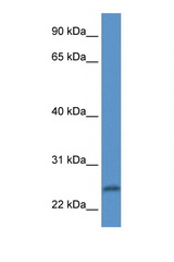 PI15 antibody LS-C135910 Western blot of Fetal Heart lysate. Antibody concentration 1 ug/ml.