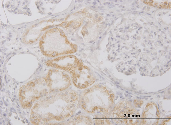 Immunoperoxidase of monoclonal antibody to PI15 on formalin-fixed paraffin-embedded human kidney. [antibody concentration 3 ug/ml]