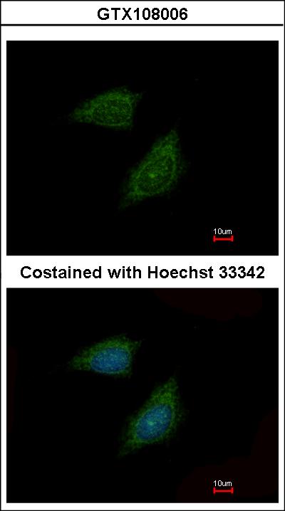 Immunofluorescence of methanol-fixed HeLa using Protease Inhibitor 15 antibody at 1:500 dilution.