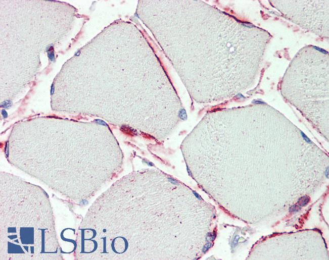 Anti-PI15 antibody IHC staining of human skeletal muscle. Immunohistochemistry of formalin-fixed, paraffin-embedded tissue after heat-induced antigen retrieval. Antibody LS-B9555 concentration 5 ug/ml.