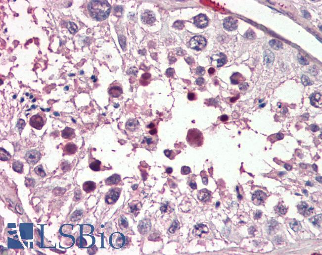 Anti-PIAS2 antibody IHC of human testis. Immunohistochemistry of formalin-fixed, paraffin-embedded tissue after heat-induced antigen retrieval. Antibody LS-B3240 concentration 75 ug/ml.