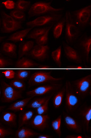 Immunofluorescence analysis of U20S cell using PIAS2 antibody. Blue: DAPI for nuclear staining.