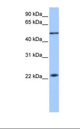Fetal liver lysate. Antibody concentration: 1.0 ug/ml. Gel concentration: 12%.