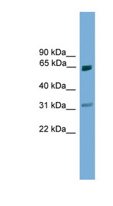 PIAS2 antibody LS-C116154 Western blot of Mouse Thymus lysate.