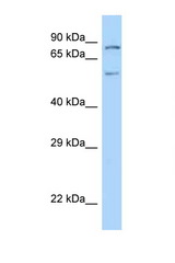 PIAS2 antibody LS-C146213 Western blot of Mouse Heart lysate. Antibody concentration 1 ug/ml.