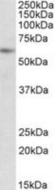 PIAS2 antibody (1 ug/ml) staining of Human Peripheral Lymphocytes lysate (35 ug protein/ml in RIPA buffer). Primary incubation was 1 hour. Detected by chemiluminescence.