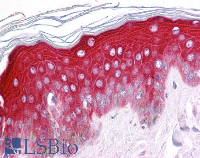 Anti-PIAS3 antibody IHC of human skin. Immunohistochemistry of formalin-fixed, paraffin-embedded tissue after heat-induced antigen retrieval. Antibody LS-B5091 concentration 5 ug/ml.