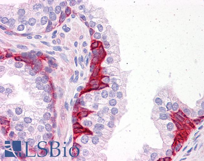 Anti-PIAS3 antibody IHC of human prostate. Immunohistochemistry of formalin-fixed, paraffin-embedded tissue after heat-induced antigen retrieval. Antibody LS-B5091 concentration 5 ug/ml.