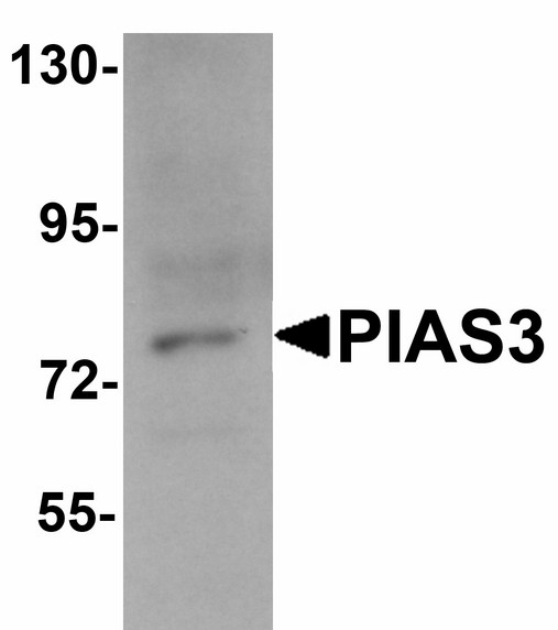 Western blot of PIAS3 in K562 cell lysate with PIAS3 antibody at 1 ug/ml.