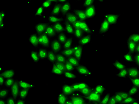 Immunofluorescence blot of U20S cell using PIAS3 antibody.
