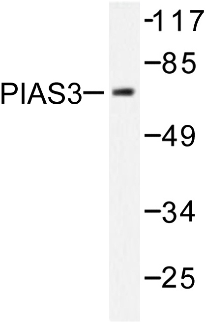 Western blot of PIAS3 (F25) pAb in extracts from 293 cells treated with UV 5'.