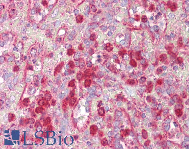 Anti-PIAS3 antibody IHC of human spleen. Immunohistochemistry of formalin-fixed, paraffin-embedded tissue after heat-induced antigen retrieval. Antibody LS-B7646 concentration 10 ug/ml.