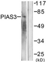 Western blot of extracts from 293 cells, treated with UV 5', using PIAS3 Antibody. The lane on the right is treated with the synthesized peptide.