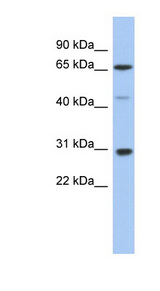 PIAS3 antibody LS-C109712 Western blot of Fetal Spleen lysate.