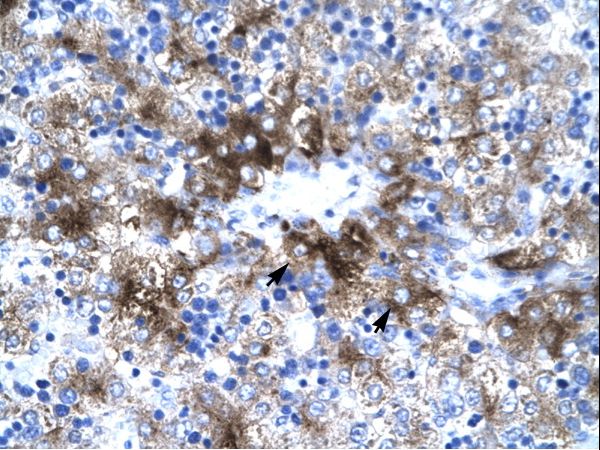 PIAS3 antibody LS-C31333 was used in IHC to stain formalin-fixed, paraffin-embedded human liver.