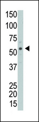 The anti-PRKCABP antibody is used in Western blot to detect PRKCABP in Y79 cell lysate.