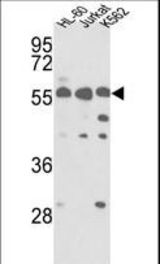 Western blot of hPRKCABP-C300 in HL-60, Jurkat, K562 cell line lysates (35 ug/lane). PRKCABP (arrow) was detected using the purified antibody.