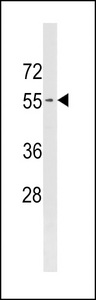 PIGB Antibody western blot of HeLa cell line lysates (35 ug/lane). The PIGB antibody detected the PIGB protein (arrow).