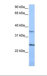 Jurkat cell lysate. Antibody concentration: 1.0 ug/ml. Gel concentration: 12%.
