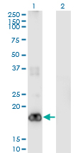 Western Blot analysis of PIGH expression in transfected 293T cell line by PIGH monoclonal antibody (M01), clone 2F8.Lane 1: PIGH transfected lysate (Predicted MW: 21.1 KDa).Lane 2: Non-transfected lysate.