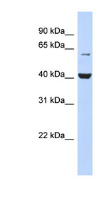 PIGK antibody LS-C101857 Western blot of Fetal Pancreas lysate.