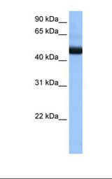 Jurkat cell lysate. Antibody concentration: 0.5 ug/ml. Gel concentration: 12%.