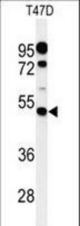Western blot of PIGM Antibody in T47D cell line lysates (35 ug/lane). PIGM (arrow) was detected using the purified antibody.