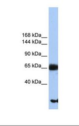 Hela cell lysate. Antibody concentration: 1.0 ug/ml. Gel concentration: 6%-18%.