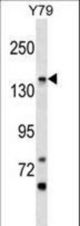 PIGO Antibody western blot of Y79 cell line lysates (35 ug/lane). The PIGO antibody detected the PIGO protein (arrow).