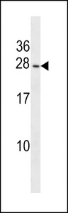 PIGP Antibody western blot of T47D cell line lysates (35 ug/lane). The PIGP antibody detected the PIGP protein (arrow).