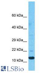 PIGP antibody Western Blot of Fetal Liver. Antibody dilution: 1 ug/ml.
