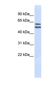 PIGQ antibody LS-C102227 Western blot of Jurkat lysate.
