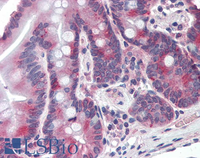 Anti-PIGR antibody LS-A8426 IHC of human small intestine. Immunohistochemistry of formalin-fixed, paraffin-embedded tissue after heat-induced antigen retrieval.