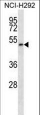 PIGT Antibody western blot of NCI-H292 cell line lysates (35 ug/lane). The PIGT antibody detected the PIGT protein (arrow).