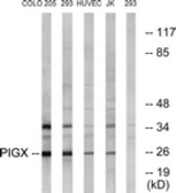 Western blot of extracts from 293/COLO/HUVEC/Jurkat cells, using PIGX Antibody. The lane on the right is treated with the synthesized peptide.