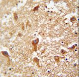 PIGX antibody immunohistochemistry of formalin-fixed and paraffin-embedded human brain tissue followed by peroxidase-conjugated secondary antibody and DAB staining.